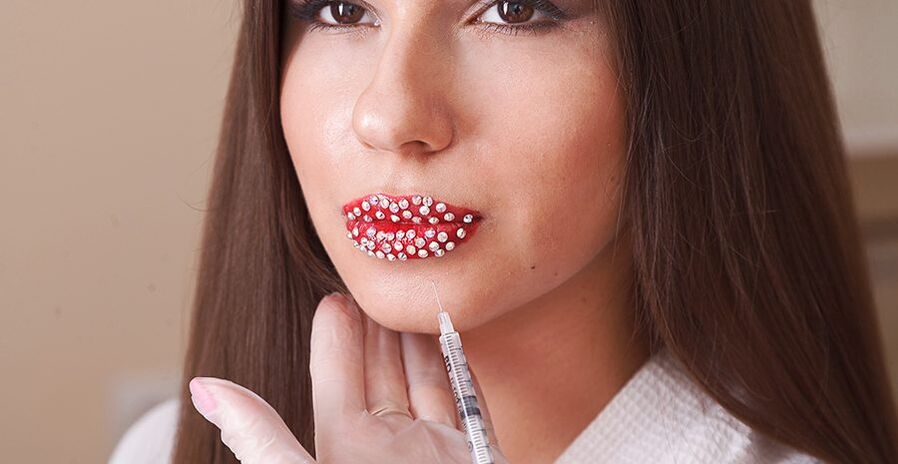 فلرز کا استعمال کرتے ہوئے جمالیاتی ہونٹوں میں اضافہ اور اصلاح